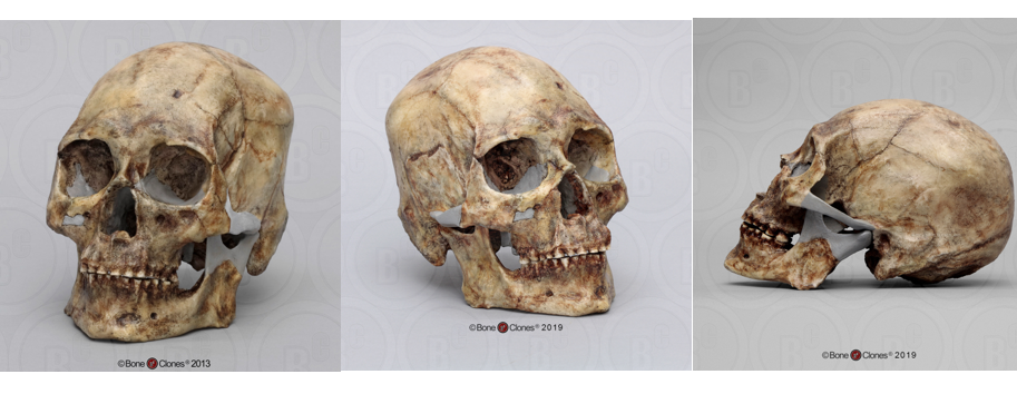 Anthropology Forensic Skulls